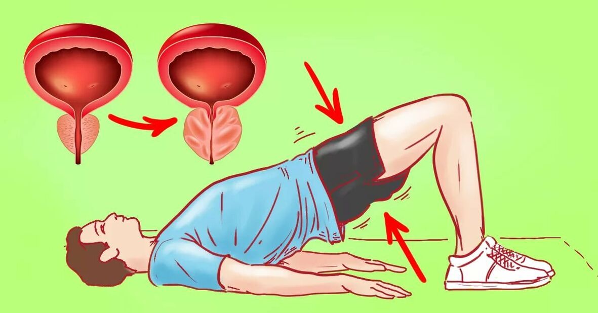 Pratimai nuo prostatito